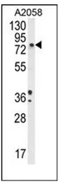 Dopamine beta Hydroxylase (DBH) (N-term) Rabbit Polyclonal Antibody - image 1