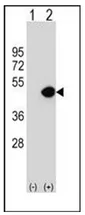 Dynamitin (DCTN2) (Center) Rabbit Polyclonal Antibody - image 1