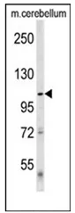 ULK1 Rabbit Polyclonal Antibody - image 1