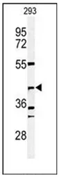 DFFB (N-term) Rabbit Polyclonal Antibody - image 1