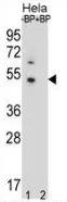 DNAJB6 (Center) Rabbit Polyclonal Antibody - image 1