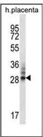 RBJ (DNAJC27) (N-term) Rabbit Polyclonal Antibody - image 1