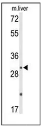 DUSP2 (C-term) Rabbit Polyclonal Antibody - image 1