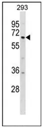 DYRK1B (Center) Rabbit Polyclonal Antibody - image 1