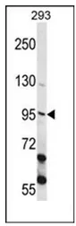 ECT2 (Center) Rabbit Polyclonal Antibody - image 1