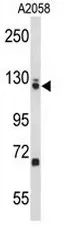 EFTUD2 (Center) Rabbit Polyclonal Antibody - image 1