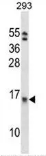 EIF1B (C-term) Rabbit Polyclonal Antibody - image 1