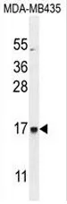 EIF3A (C-term) Rabbit Polyclonal Antibody - image 1