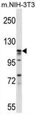 eIF3s8 (EIF3C) (Center) Rabbit Polyclonal Antibody - image 1