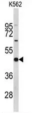 EIF4A2 (C-term) Rabbit Polyclonal Antibody - image 1