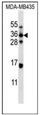 ELOVL5 (C-term) Rabbit Polyclonal Antibody - image 1