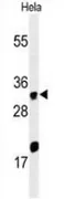 ELOVL5 (C-term) Rabbit Polyclonal Antibody - image 1