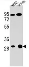 ETFA (C-term) Rabbit Polyclonal Antibody - image 1