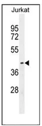 ETS1 (N-term) Rabbit Polyclonal Antibody - image 1