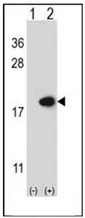 FABP2 (N-term) Rabbit Polyclonal Antibody - image 1