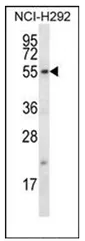 Fbx15 (FBXO15) (N-term) Rabbit Polyclonal Antibody - image 1