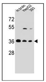 FBXO2 (C-term) Rabbit Polyclonal Antibody - image 1