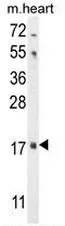 FGF16 (N-term) Rabbit Polyclonal Antibody - image 1