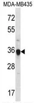 FGL1 (C-term) Rabbit Polyclonal Antibody - image 1
