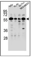 FOXC2 (Center) Rabbit Polyclonal Antibody - image 1