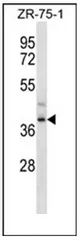 FPR3 (C-term) Rabbit Polyclonal Antibody - image 1