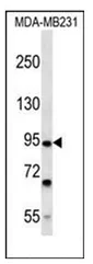 FSD2 (N-term) Rabbit Polyclonal Antibody - image 1