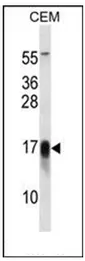 Dysadherin (FXYD5) (Center) Rabbit Polyclonal Antibody - image 1
