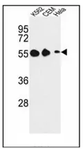 GALR1 (Center) Rabbit Polyclonal Antibody - image 1