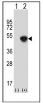 GCAT (N-term) Rabbit Polyclonal Antibody - image 1