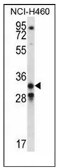 GDF15 (N-term) Rabbit Polyclonal Antibody - image 1