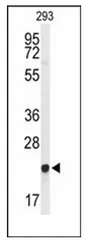 GGCT (C-term) Rabbit Polyclonal Antibody - image 1