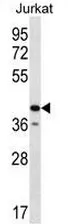 GORASP2 (Center) Rabbit Polyclonal Antibody - image 1