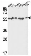 Glucose 6 phosphate isomerase (GPI) (C-term) Rabbit Polyclonal Antibody - image 1