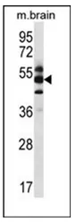 CSN1 (GPS1) (Center) Rabbit Polyclonal Antibody - image 1