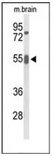 GRB7 (Center) Rabbit Polyclonal Antibody - image 1