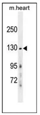 NMDAR2A (GRIN2A) (Center) Rabbit Polyclonal Antibody - image 1