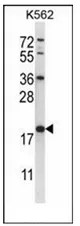 GSTM5 (N-term) Rabbit Polyclonal Antibody - image 1