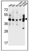 GTF2H2C (C-term) Rabbit Polyclonal Antibody - image 1