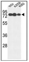 beta glucuronidase (GUSB) (Center) Rabbit Polyclonal Antibody - image 1
