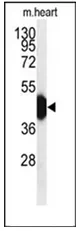 Repulsive Guidance Molecule C (HFE2) (Center) Rabbit Polyclonal Antibody - image 1