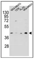 HHLA2 (N-term) Rabbit Polyclonal Antibody - image 1
