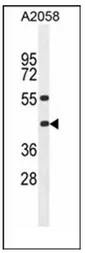 HLAB (HLA-B) (Center) Rabbit Polyclonal Antibody - image 1
