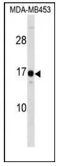 HMGN3 (N-term) Rabbit Polyclonal Antibody - image 1