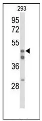 HNF 4 alpha (HNF4A) (N-term) Rabbit Polyclonal Antibody - image 1