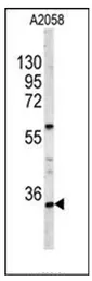 HOXA9 (C-term) Rabbit Polyclonal Antibody - image 1