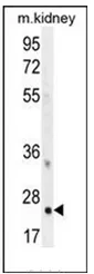 HOXB6 (Center) Rabbit Polyclonal Antibody - image 1