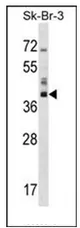 HSD17B1 (C-term) Rabbit Polyclonal Antibody - image 1