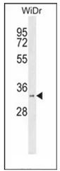 HSD17B11 (N-term) Rabbit Polyclonal Antibody - image 1