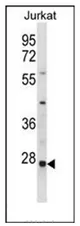 TIP30 (HTATIP2) (N-term) Rabbit Polyclonal Antibody - image 1