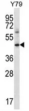 IFNGR1 (C-term) Rabbit Polyclonal Antibody - image 1